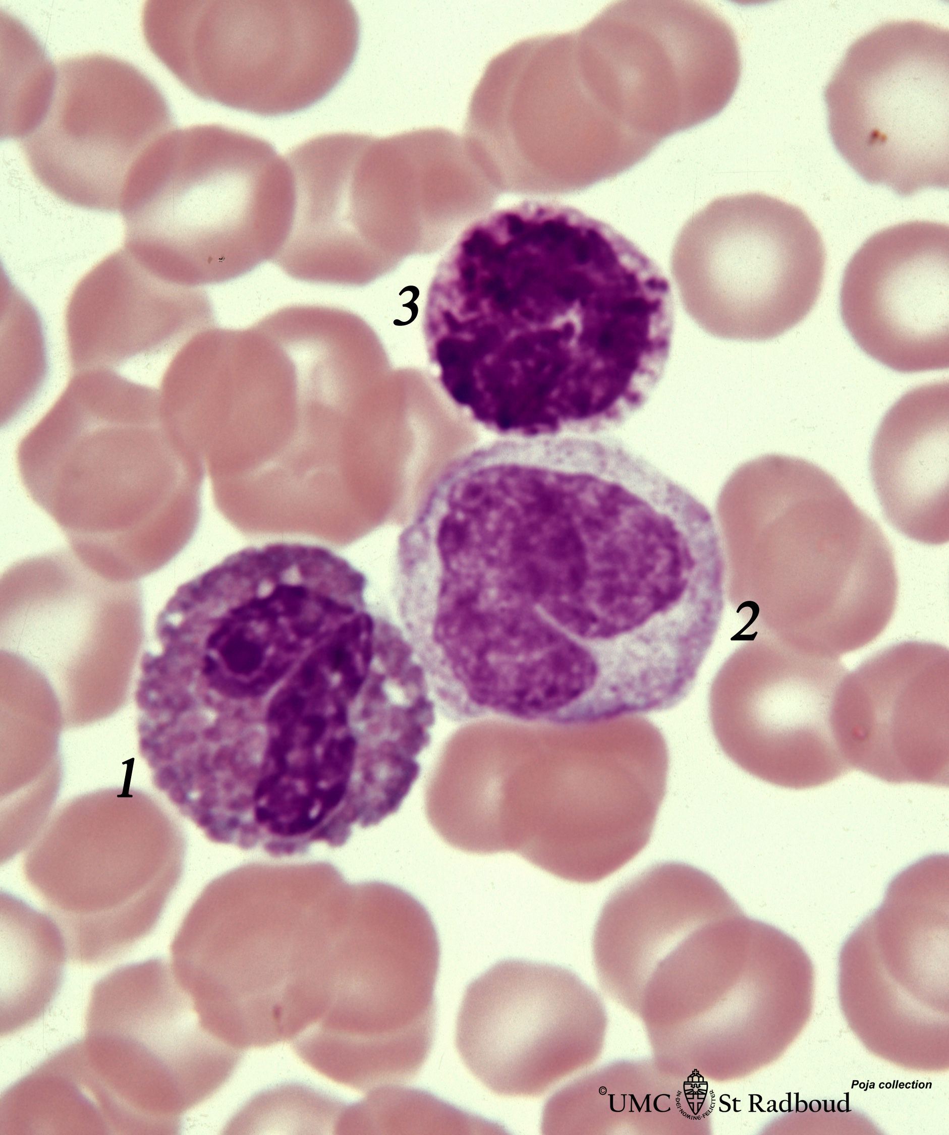 Eosinophil, monocyte and basophil in blood smear (human) | Eccles Health  Sciences Library | J. Willard Marriott Digital Library